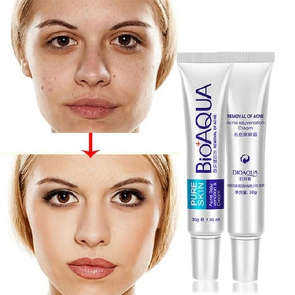 Crema Facial AntiAcné || BIOAQUA